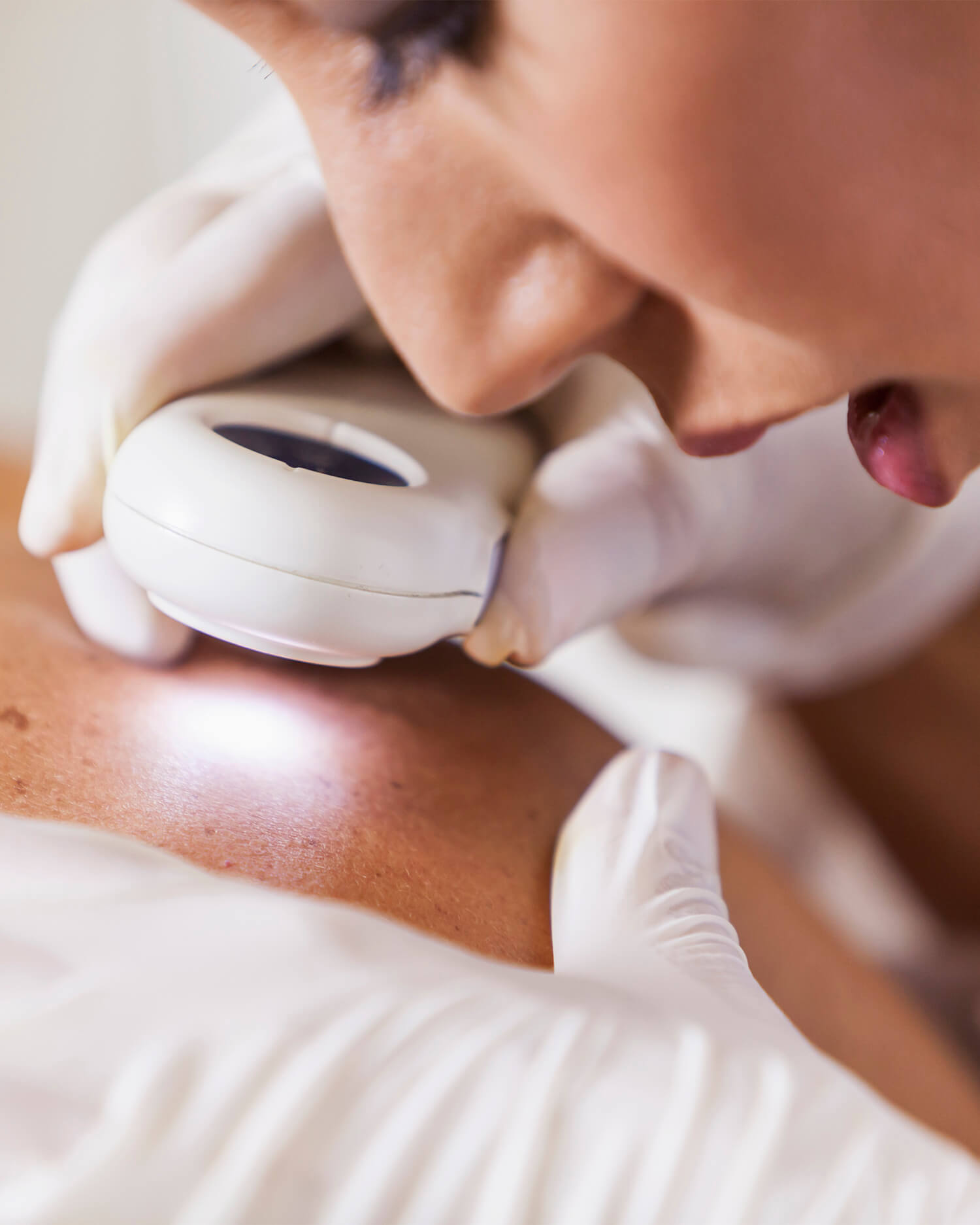 Odos navikų dermatoskopija